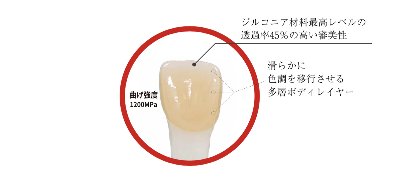 R-1（フルジルコニアクラウン）